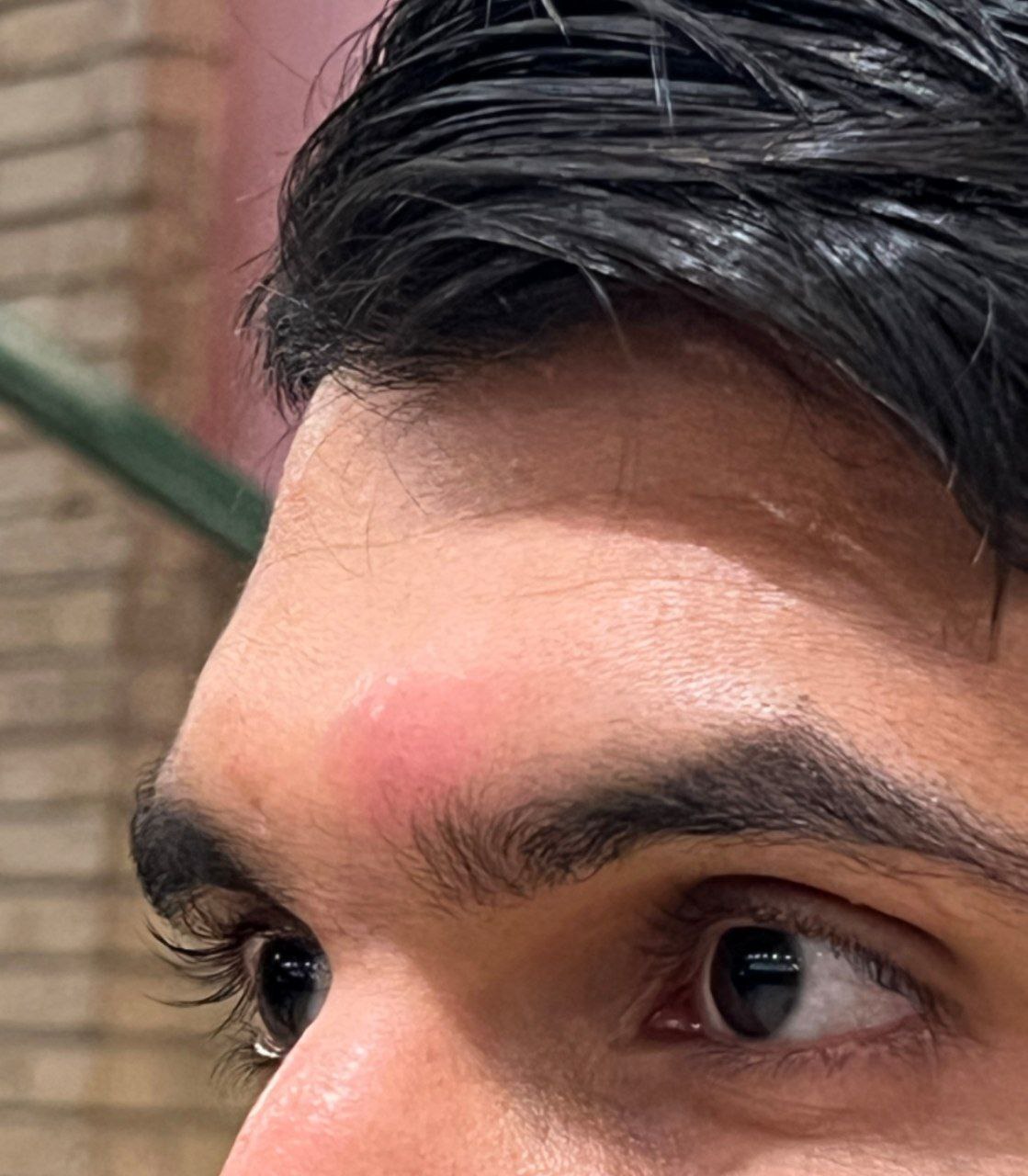 تورم پیشانی و بینی ابوالفضل سلیمانی بهعلت ضربه سر رامین رضاییان به او+تصاویر تورم پیشانی و بینی ابوالفضل سلیمانی بهعلت ضربه سر رامین رضاییان به او+تصاویر