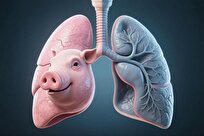 نخستین-ریه-خوکی-در-بدن-انسان-نفس-کشید