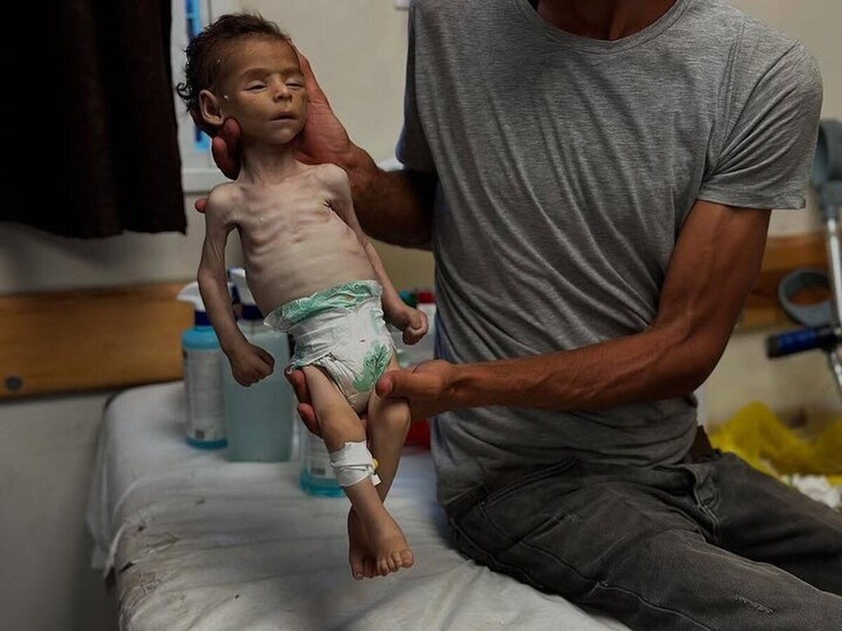 غزه در آتش و قحطی | صهیونیست‌ها کودکان را با بمب و گرسنگی می‌کشند