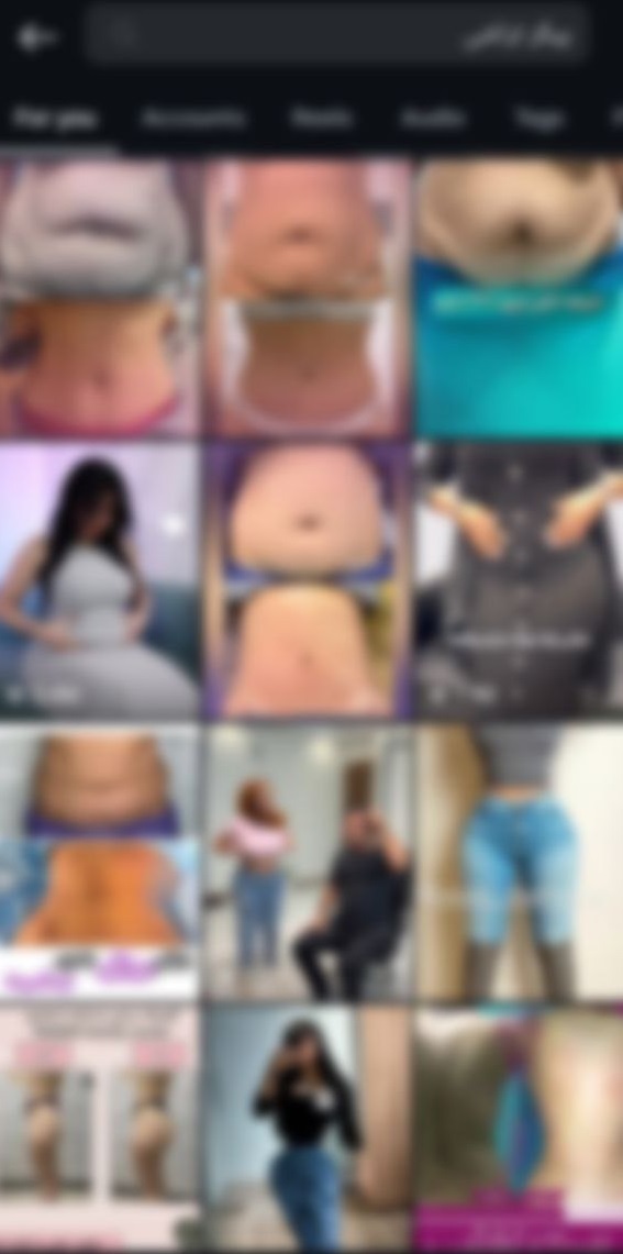 بدن بیماران در ویترین تبلیغات زیبایی؛ بحران اخلاقی در سایهی بینظارتی بدن بیماران در ویترین تبلیغات زیبایی؛ بحران اخلاقی در سایهی بینظارتی