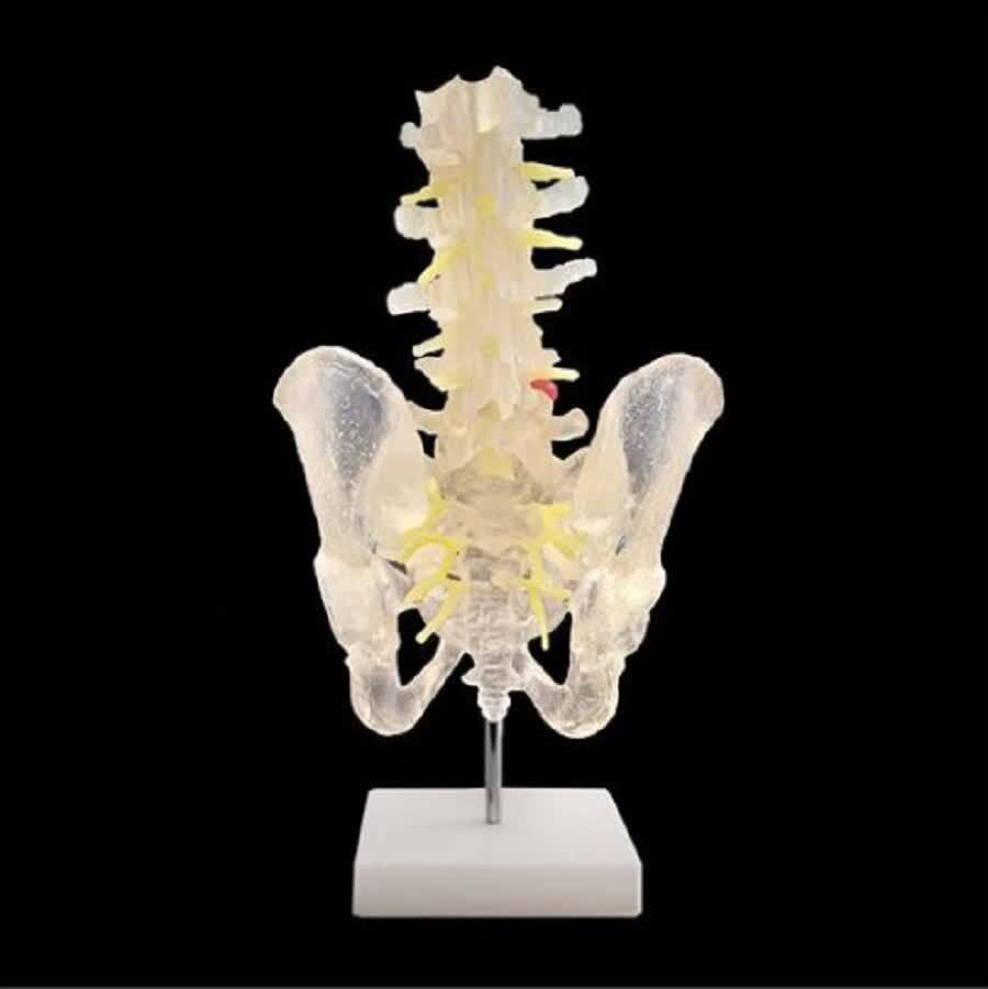 فناوری چاپ سه بعدی در پزشکی؛ از ارتز و پروتزهای سفارشی تا انواع مولاژها +فیلم و عکس