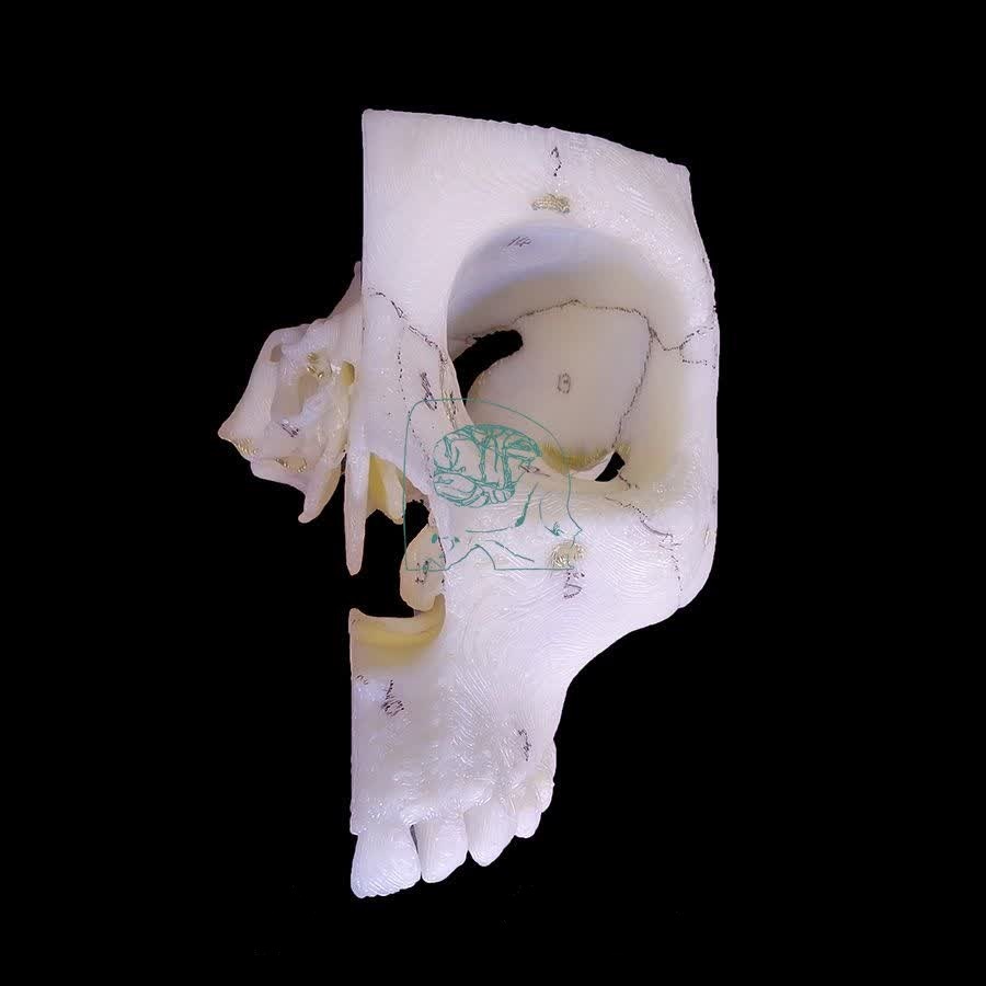 فناوری چاپ سه بعدی در پزشکی؛ از ارتز و پروتزهای سفارشی تا انواع مولاژها +فیلم و عکس