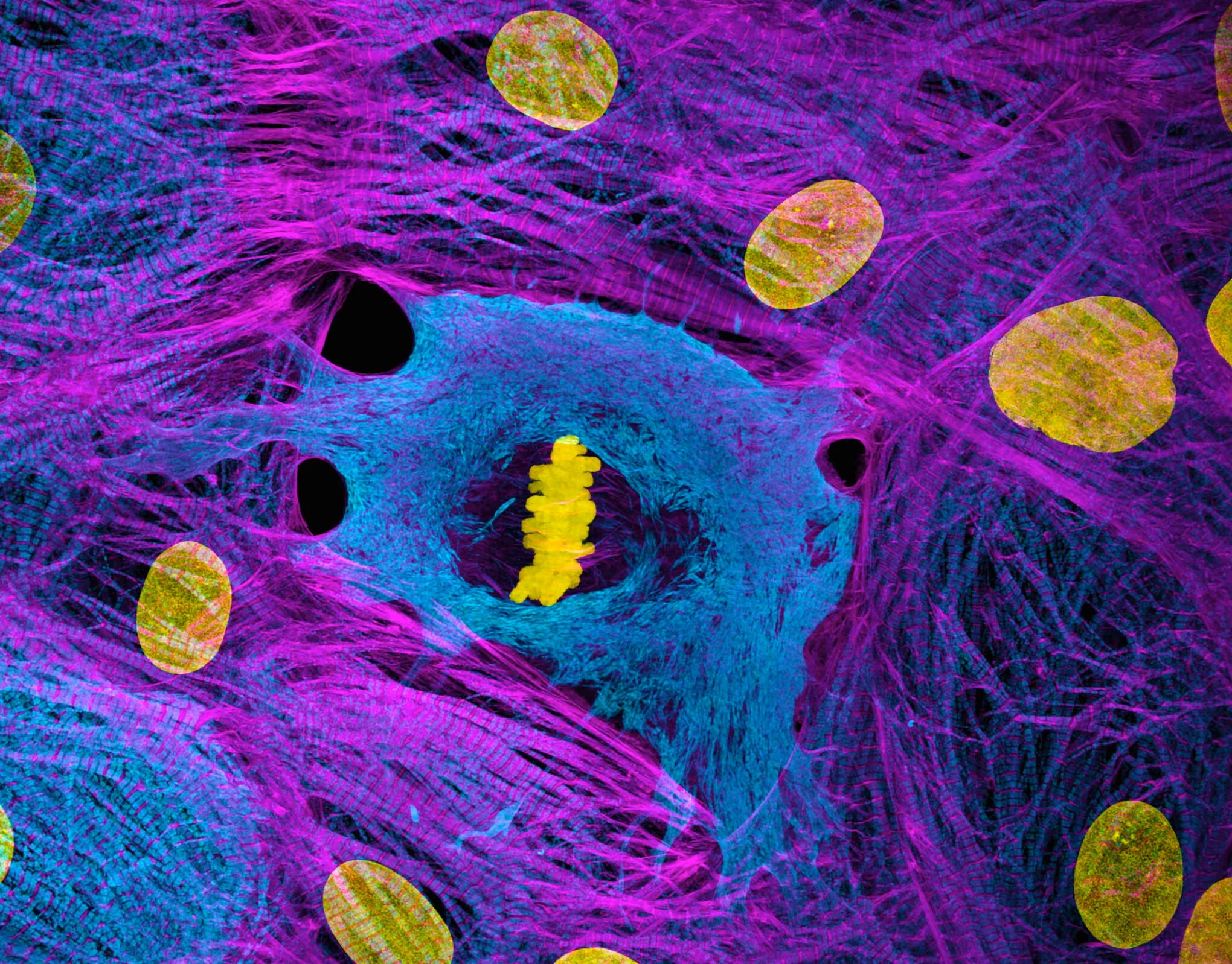 سلولهای عضله قلب مشتق از سلولهای بنیادی سلولهای عضله قلب مشتق از سلولهای بنیادی