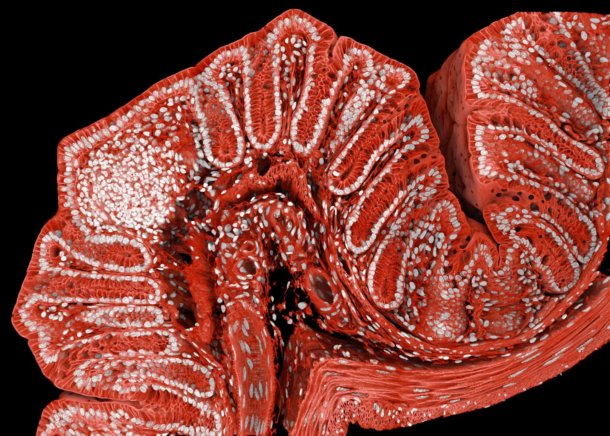 روده بزرگ موش روده بزرگ موش