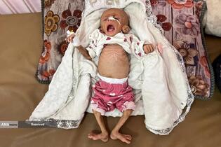 حملات وحشیانه رژیم اشغالگر علیه غیرنظامیان در سراسر نوار غزه