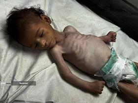 گرسنگی فاجعه بار در غزه