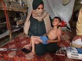 گرسنگی فاجعه بار در غزه