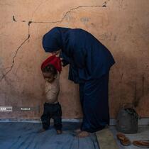 گرسنگی فاجعه بار در غزه