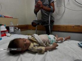 گرسنگی فاجعه بار در غزه