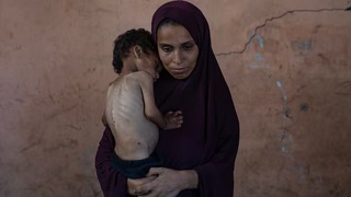 محاصره بی‌رحمانه غزه حکایت از مرگ کودکان و سالمندان بر اثر گرسنگی و سوءتغذیه دارد