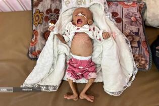 محاصره بی‌رحمانه غزه حکایت از مرگ کودکان و سالمندان بر اثر گرسنگی و سوءتغذیه دارد