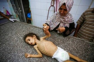 محاصره بی‌رحمانه غزه حکایت از مرگ کودکان و سالمندان بر اثر گرسنگی و سوءتغذیه دارد