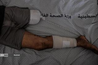 بحران انسانی در غزه