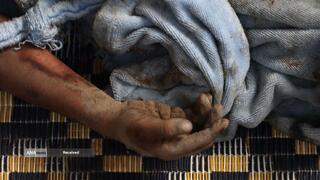 بحران انسانی در غزه