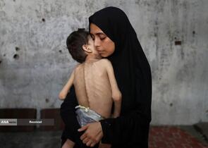 بحران گرسنگی رو به وخامت غزه همزمان با تشدید هشدارهای قحطی