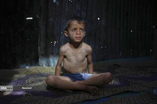 شدیدترین محاصره انسانی عصر حاضر در نوازه