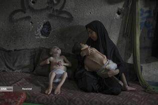 کودکان غزه در صف مرگ بدلیل سوء‌تغذیه، گرسنگی، و کمبود کمک‌ها و خدمات حیاتی