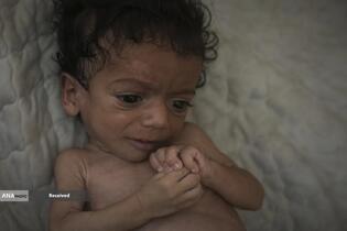 کودکان غزه در صف مرگ بدلیل سوء‌تغذیه، گرسنگی، و کمبود کمک‌ها و خدمات حیاتی