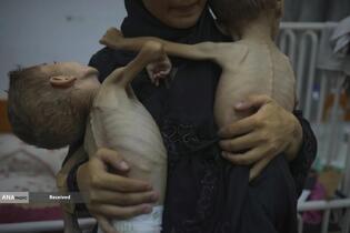 کودکان غزه در صف مرگ بدلیل سوء‌تغذیه، گرسنگی، و کمبود کمک‌ها و خدمات حیاتی