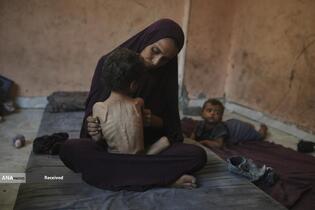 کودکان غزه در صف مرگ بدلیل سوء‌تغذیه، گرسنگی، و کمبود کمک‌ها و خدمات حیاتی