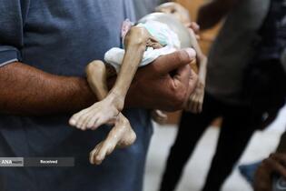 کودکان غزه در صف مرگ بدلیل سوء‌تغذیه، گرسنگی، و کمبود کمک‌ها و خدمات حیاتی