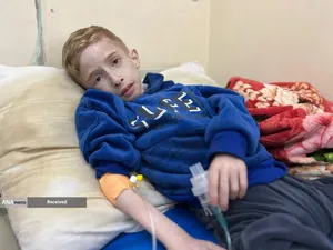 کودکانی که در غزه بر اثر گرسنگی تبدیل به اسکلت شده&zwnj;اند