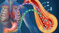 مقاومت به انسولین (Insulin Resistance) چیست؟
