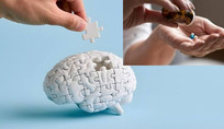 Genetic profile may determine who benefits from aspirin against dementia