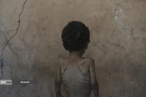 کودکان غزه در صف مرگ بدلیل سوء&zwnj;تغذیه، گرسنگی، و کمبود کمک&zwnj;ها و خدمات حیاتی