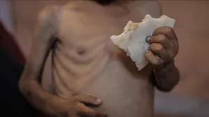 محاصره بی&zwnj;رحمانه غزه حکایت از مرگ کودکان و سالمندان بر اثر گرسنگی و سوءتغذیه دارد