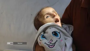 کودکانی که در غزه بر اثر گرسنگی تبدیل به اسکلت شده&zwnj;اند