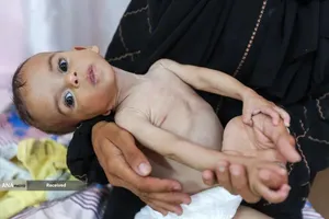 کودکانی که در غزه بر اثر گرسنگی تبدیل به اسکلت شده&zwnj;اند