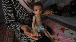 محاصره بی&zwnj;رحمانه غزه حکایت از مرگ کودکان و سالمندان بر اثر گرسنگی و سوءتغذیه دارد