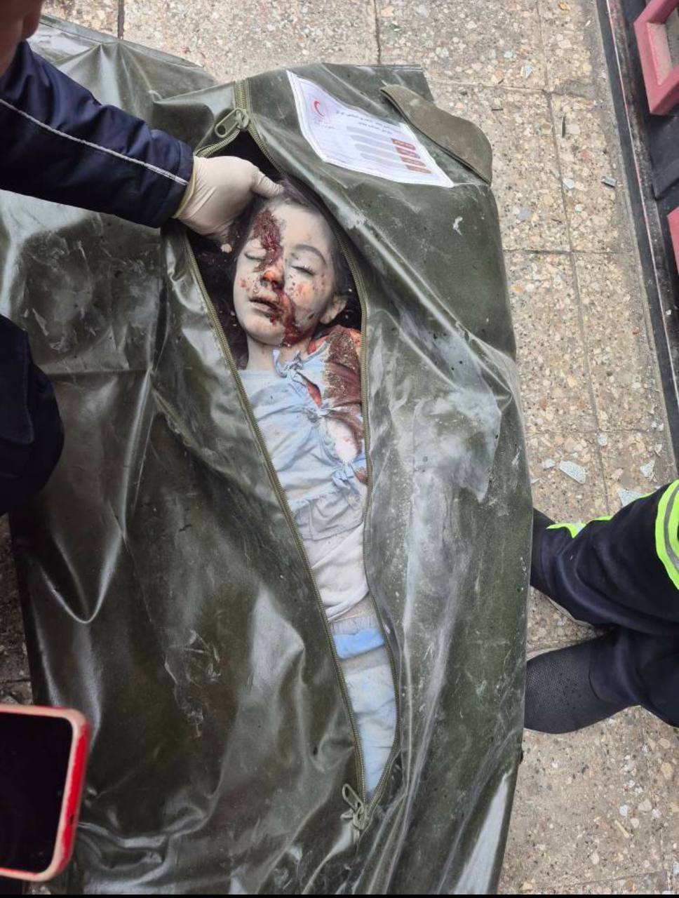 شهادت دختر ۷ ساله در حمله امروز رژیم صهیونیستی به تهران/ مجروحیت سه کودک دیگر شهادت دختر ۷ ساله در حمله امروز رژیم صهیونیستی به تهران/ مجروحیت سه کودک دیگر