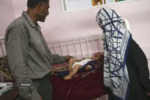 کودکانی که در غزه بر اثر گرسنگی تبدیل به اسکلت شده&zwnj;اند