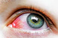 شایع‌ترین بیماری‌های شبکیه از نوزادی تا کهنسالی