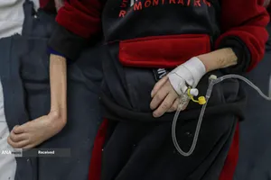 کودکانی که در غزه بر اثر گرسنگی تبدیل به اسکلت شده&zwnj;اند