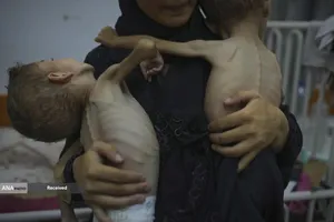 کودکان غزه در صف مرگ بدلیل سوء&zwnj;تغذیه، گرسنگی، و کمبود کمک&zwnj;ها و خدمات حیاتی