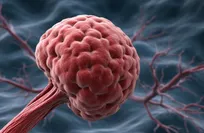 Russian Scientists Develop Nanomaterial to “Burn” Infection Sites and Tumors