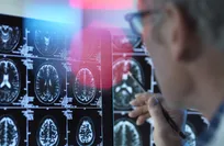 Muscle loss may be an important warning sign of dementia