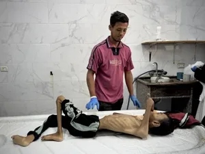 محاصره بی&zwnj;رحمانه غزه حکایت از مرگ کودکان و سالمندان بر اثر گرسنگی و سوءتغذیه دارد