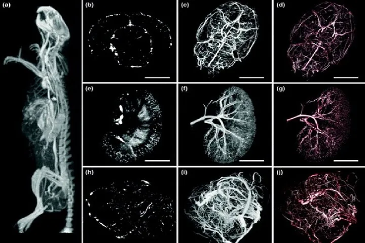 Micro-CT systems deliver micrometer-resolution imaging