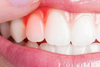 Low-Power laser boosts gum cell repair