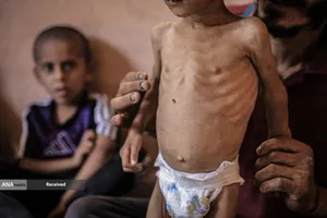 کودکانی که در غزه بر اثر گرسنگی تبدیل به اسکلت شده&zwnj;اند