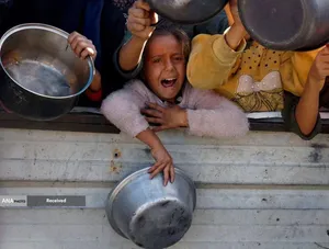 گرسنگی فاجعه بار در غزه