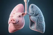 نخستین ریه خوکی در بدن انسان نفس کشید