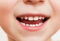 دندان دائمی ۶ سالگی؛ مهم‌ترین دندانی که زود خراب می‌شود