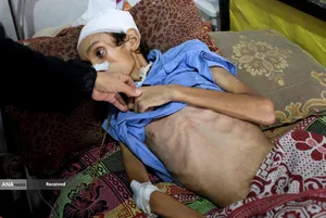 محاصره بی&zwnj;رحمانه غزه حکایت از مرگ کودکان و سالمندان بر اثر گرسنگی و سوءتغذیه دارد