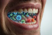 میکروب‌های ساکن دهان، کلیدی برای پیشگیری از چاقی