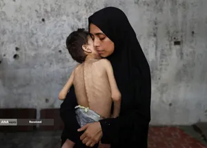 بحران گرسنگی رو به وخامت غزه همزمان با تشدید هشدارهای قحطی